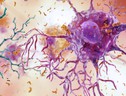 Alzheimer e Parkinson potrebbero avere un'origine comune (fonte: National Institute on Aging, NIH) (ANSA)