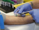 È pronto un nuovo test ‘smart’ in grado di individuare gli anticorpi presenti nel sangue contro Covid-19 (free via pixabay) (ANSA)