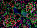 In verde le strutture del rene chiamate glomeruli, che hanno la funzione di filtrare urina e sangue (fonte: Derek Sung, National Heart, Lung, & Blood Institute) (ANSA)