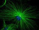 Immagine al microscopio a fluorescenza della microglia (fonte: Istituto Italiano di Tecnologia - IIT) (ANSA)