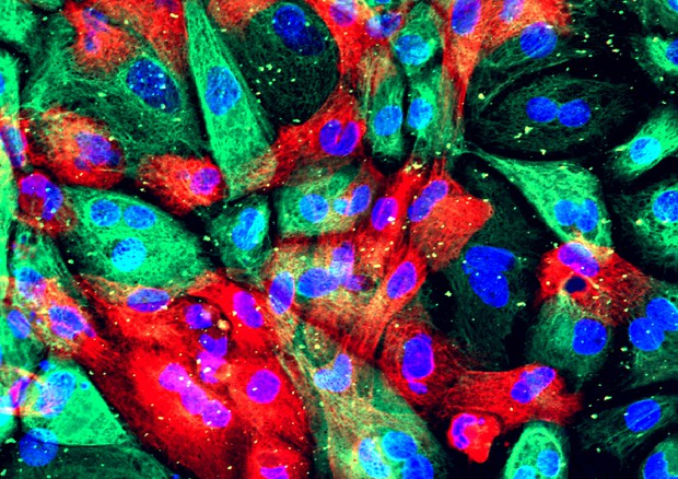 Cellule del tumore della prostata (fonte: National Institutes of Health) © Ansa