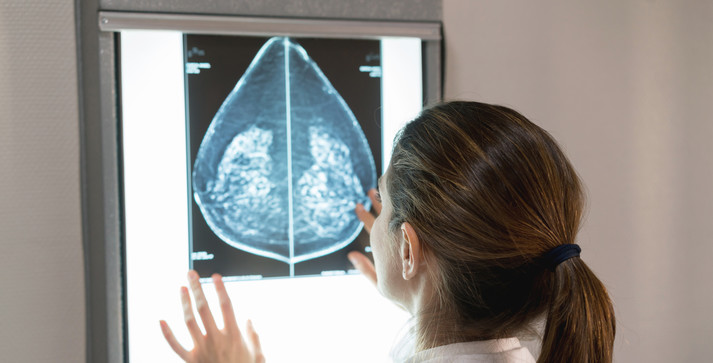 Tumore al seno, il 40% diagnosi è nelle donne under 50 (ANSA)