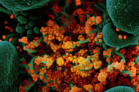 In arancione le particelle del virus SarsCoV2 (fonte: NIAID)