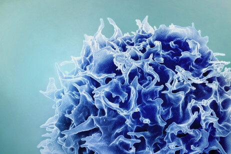 Un linfocita T. E' questo il tipo di cellula immunitaria risvegliata con le metastasi del fegato dalla terapia genica sperimentata in Italia (fonte: NIAID)