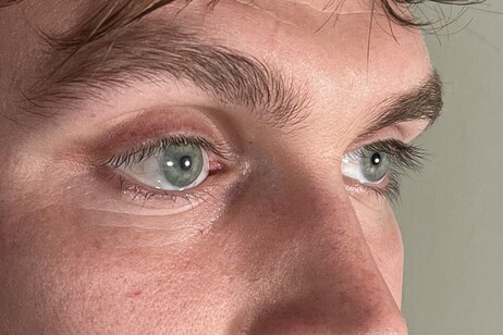 La protesi oculare è del tutto identica all’occhio sinistro sano del paziente (fonte: Stephen Bell, Ocupeye Ltd)