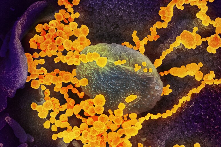 Particelle del virus SarsCoV2 sulla superficie di una cellula, viste al microscopio elettronico (fonte: NIAID) - RIPRODUZIONE RISERVATA