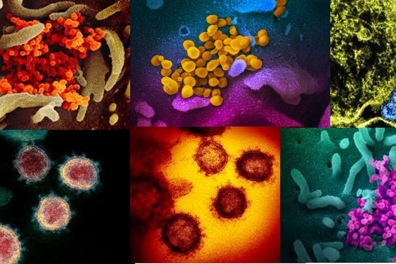 Immagini del coronavirus SarsCov2 ottenute dal Niaid con il microscopio elettronico (fonte: NIAID-RML) - RIPRODUZIONE RISERVATA