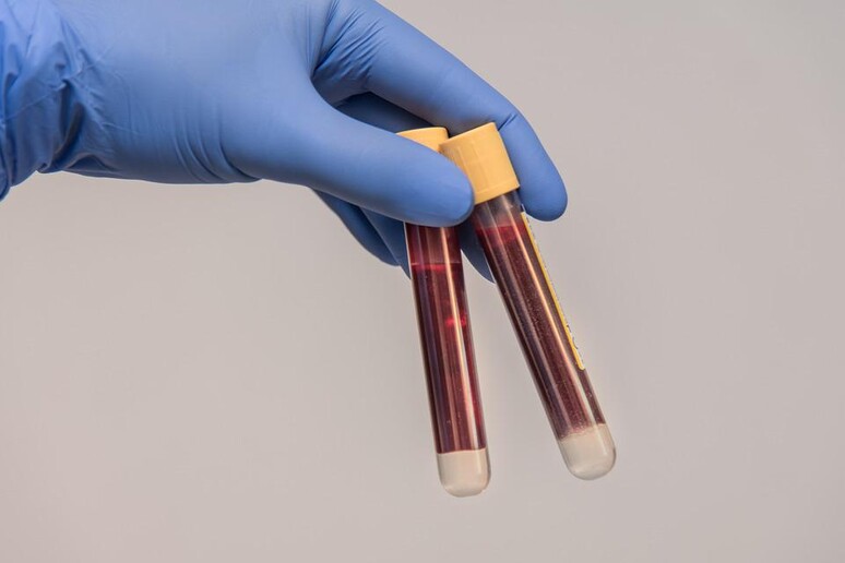 Messo a punto un nuovo test per cercare nel sangue le spie dell 'infezione da SarsCoV2 (fonte: Pixabay) - RIPRODUZIONE RISERVATA
