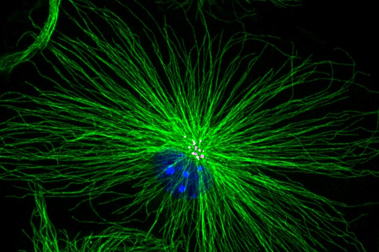 Immagine al microscopio a fluorescenza della microglia (fonte: Istituto Italiano di Tecnologia - IIT) - RIPRODUZIONE RISERVATA