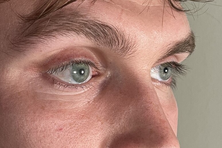 La protesi oculare è del tutto identica all’occhio sinistro sano del paziente (fonte: Stephen Bell, Ocupeye Ltd) -     RIPRODUZIONE RISERVATA
