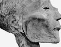 I segni del vaiolo sul volto della mummia di Ramses V (fonte: G. Elliot Smith) (ANSA)