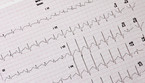 Elettrocardiogramma (ANSA)