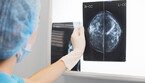 Mammografia spia problemi cuore in menopausa  (ANSA)