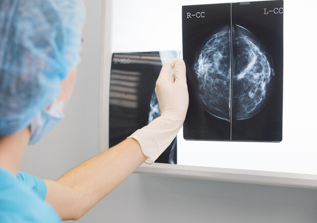 Mammografia spia problemi cuore in menopausa  © Ansa