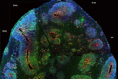 Brain organoids (Credit: Vaccarino Lab, Yale University, Science)