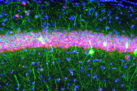 Fluorescence micrograph of hippocampal neurons (credit: Italian Institute of Technology - © IIT)