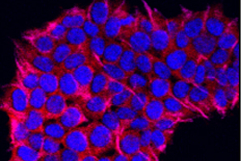 Cellule staminali del pancreas (fonte: Naotake Funamizu, S. Perwez Hussain, NCI Center for Cancer Research, National Cancer Institute, National Institutes of Health) - RIPRODUZIONE RISERVATA