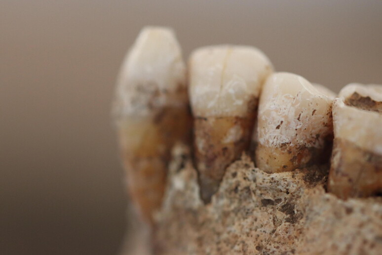 Mandibola proveniente da un campione del Neolitico (circa 5.000 a.C.) dell 'Italia meridionale (Fonte: Andrea Quagliariello) - RIPRODUZIONE RISERVATA
