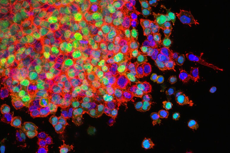 La mappa genetica dei tumori getta nuova luce su come nasconoe cambiano nel tempo le cellule malate (fonte: National Cancer Institute via unsplash) - RIPRODUZIONE RISERVATA