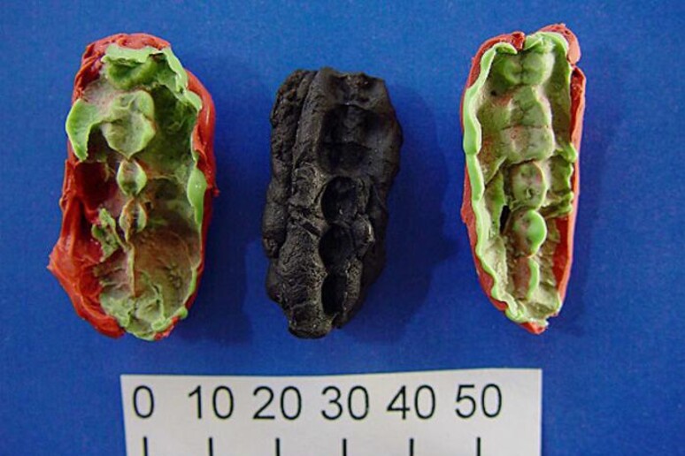 I calchi dei chewing gum preistorici mostrano le impronte dei denti (fonte: Verner Alexandersen) -     RIPRODUZIONE RISERVATA